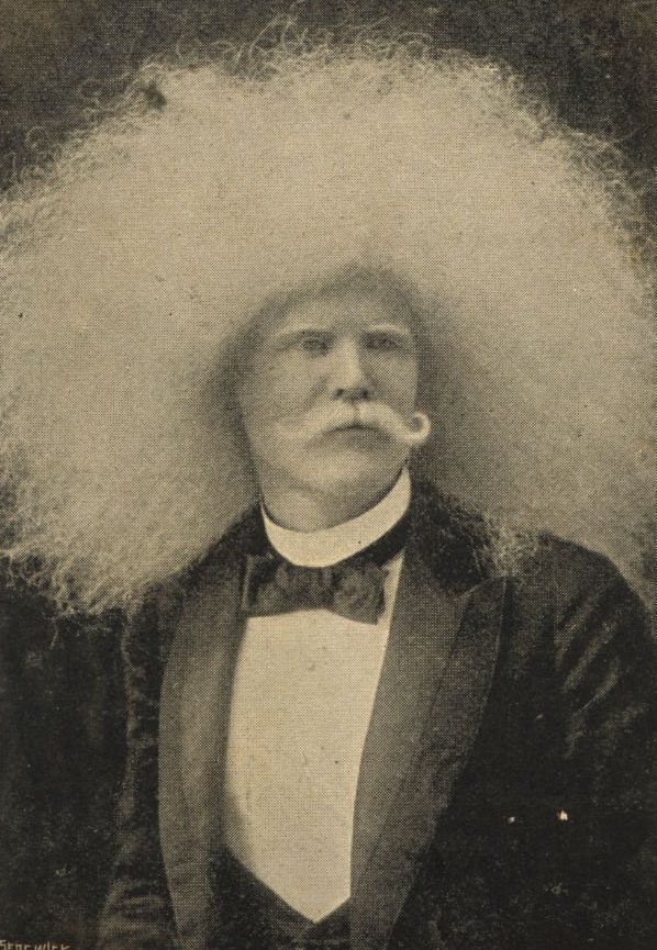 The Striking Story of Unzie: Australia&;s Albino Aborigine Man Weird
