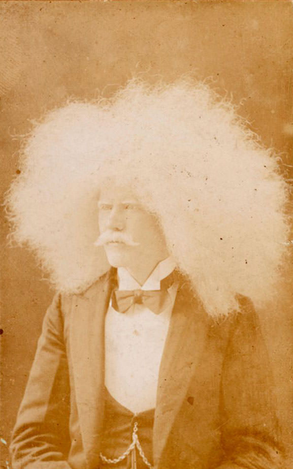 The Striking Story of Unzie: Australia&;s Albino Aborigine Man Weird