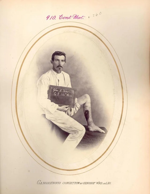 #61 John A. Dixon, Hospital Number 20,459, Serg’t, Co.
