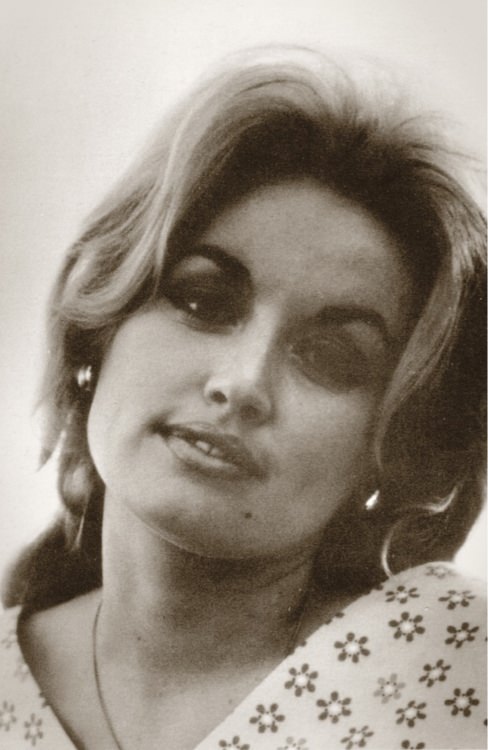 Dolly Parton’s original hair 1960s.