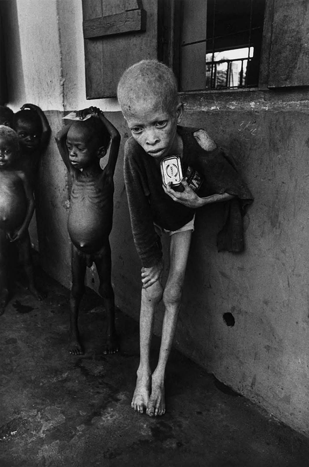 #10 Albino Boy, Biafra, 1969
