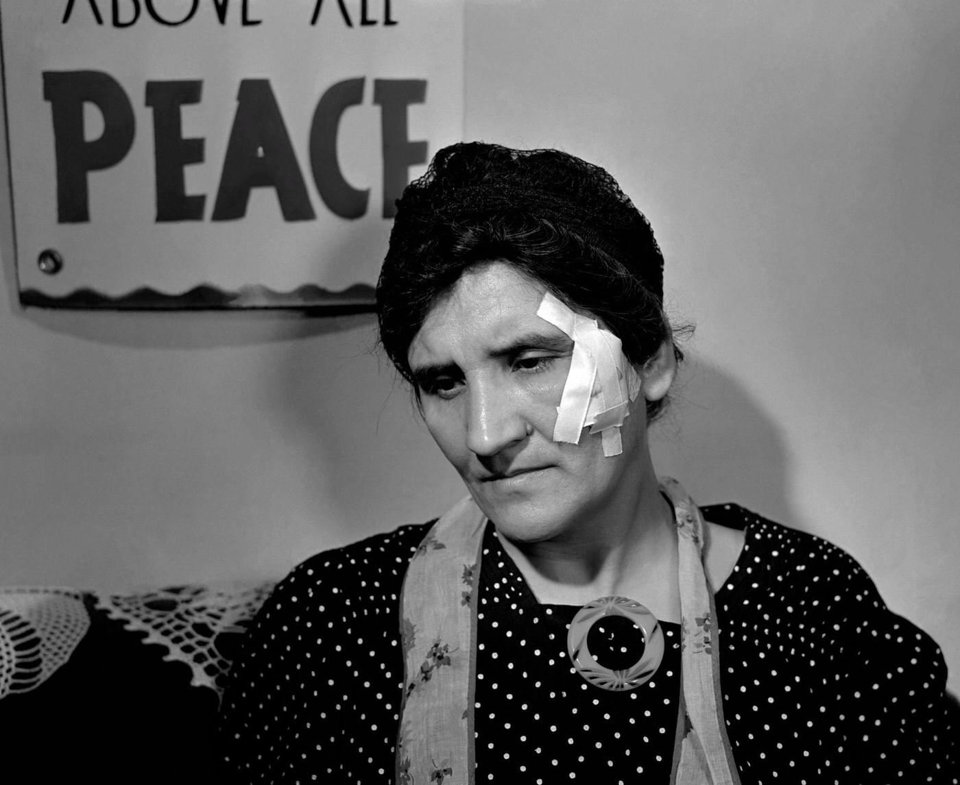 #7 An unidentified woman sits with an injury under a sign that reads, Above All Peace during the Detroit Ford Motor Company strike at the River Rouge plant in Dearborn, Michigan, April 1941.