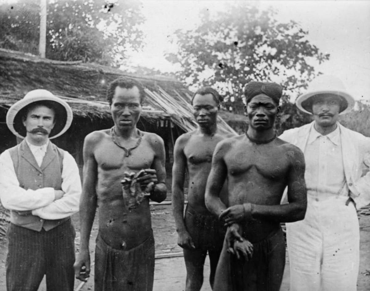 The Belgian Congo’s Hacked Hands: A Brutal Reminder of Colonial Atrocities Weird
