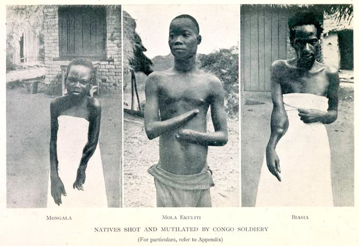 The Belgian Congo’s Hacked Hands: A Brutal Reminder of Colonial Atrocities Weird