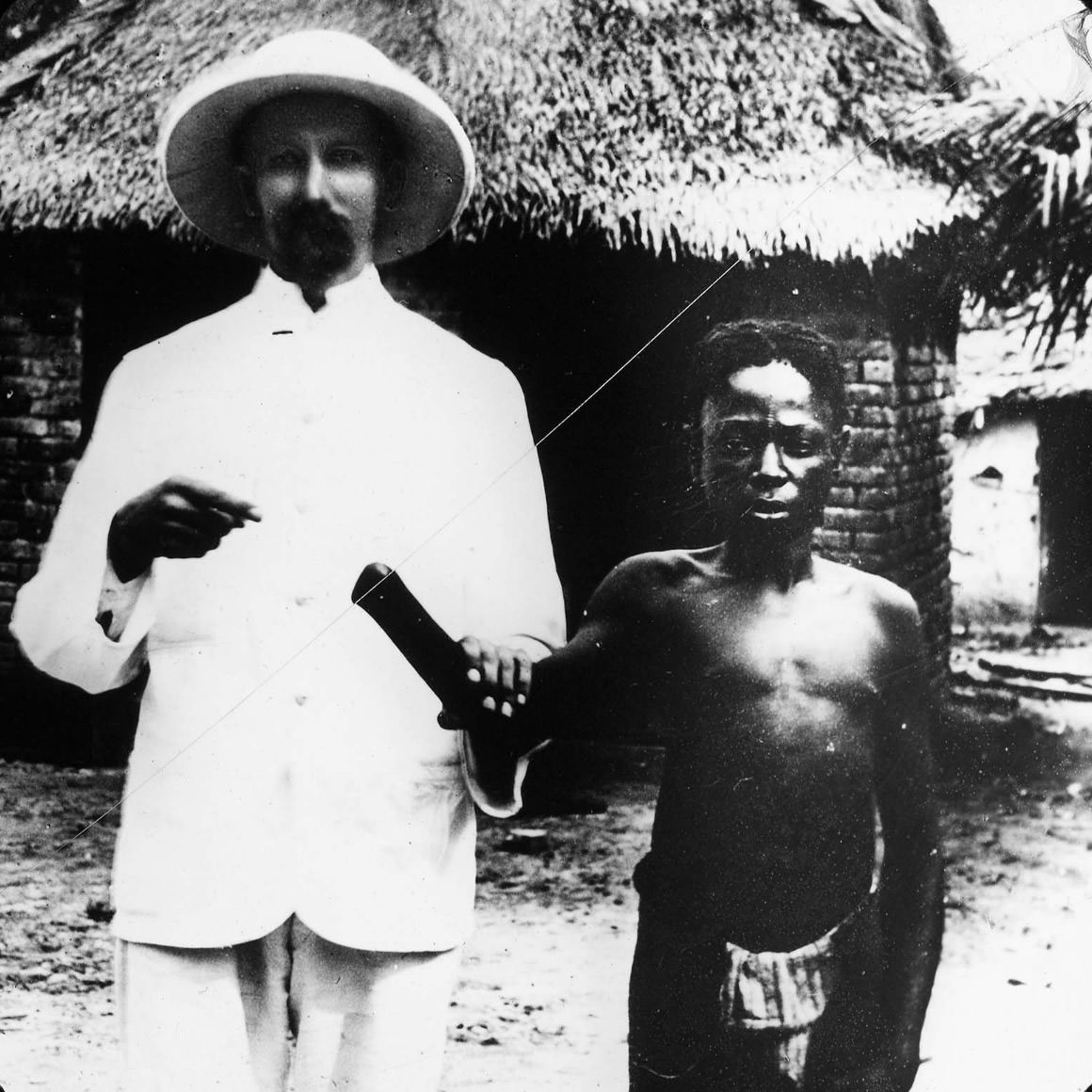 The Belgian Congo’s Hacked Hands: A Brutal Reminder of Colonial Atrocities Weird