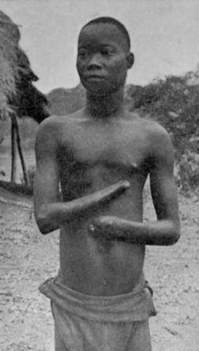 The Belgian Congo’s Hacked Hands: A Brutal Reminder of Colonial Atrocities Weird