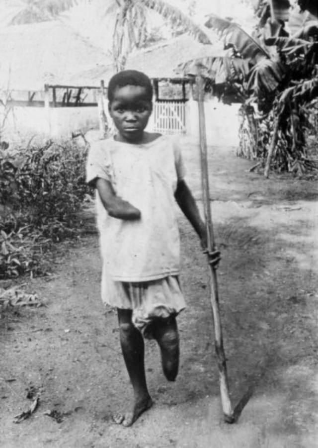 The Belgian Congo’s Hacked Hands: A Brutal Reminder of Colonial Atrocities Weird