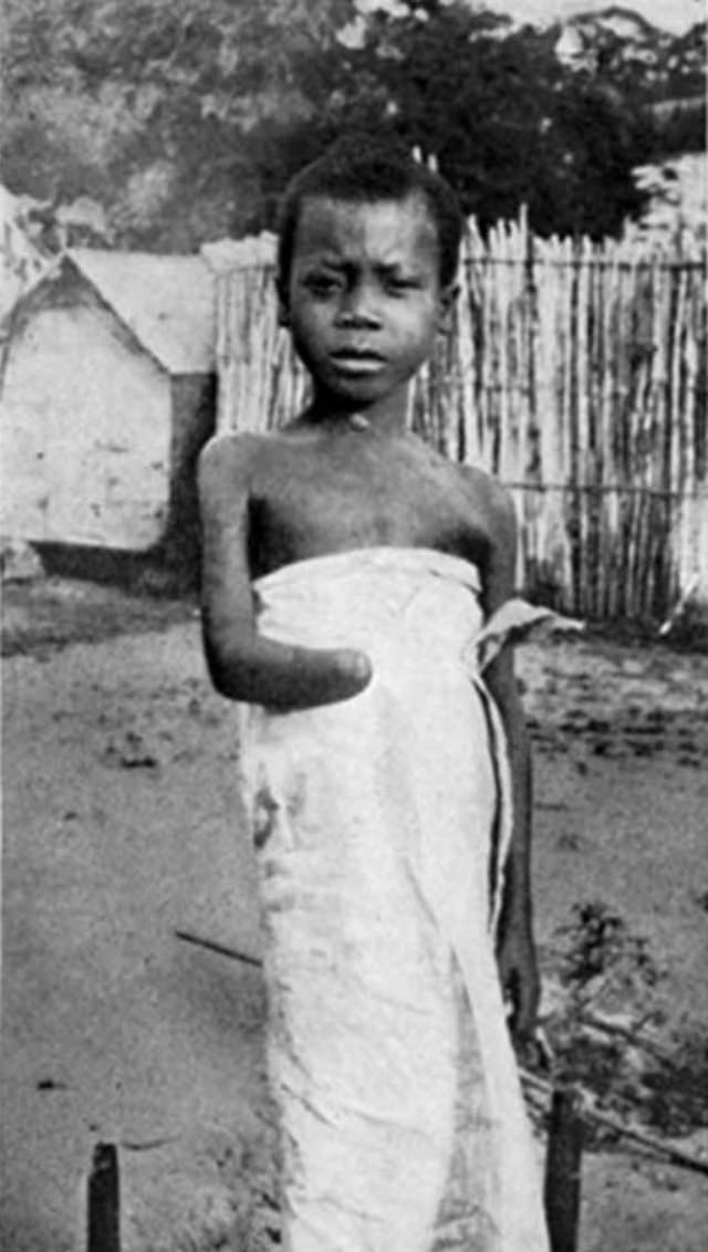 The Belgian Congo’s Hacked Hands: A Brutal Reminder of Colonial Atrocities Weird