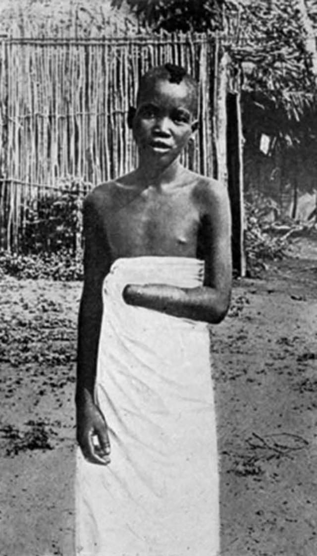 The Belgian Congo’s Hacked Hands: A Brutal Reminder of Colonial Atrocities Weird