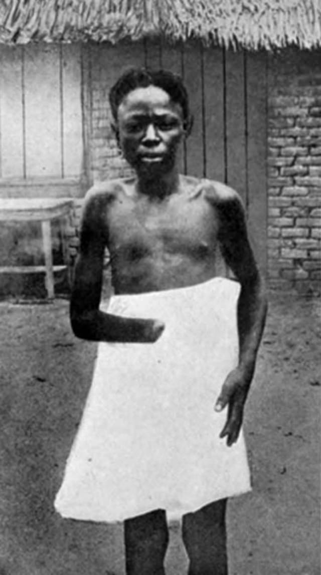 The Belgian Congo’s Hacked Hands: A Brutal Reminder of Colonial Atrocities Weird