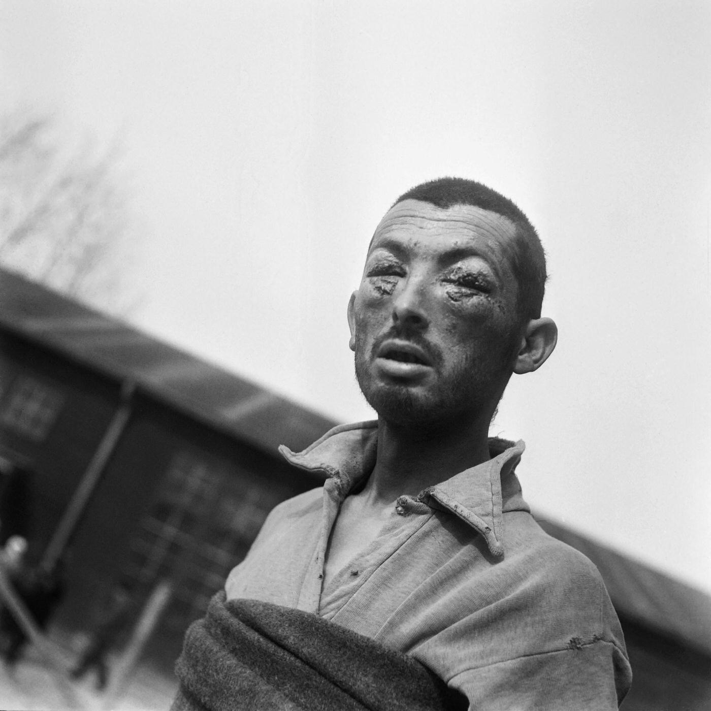 #21 A tortured prisoner seen in Buchenwald concentration camp in April 1945.