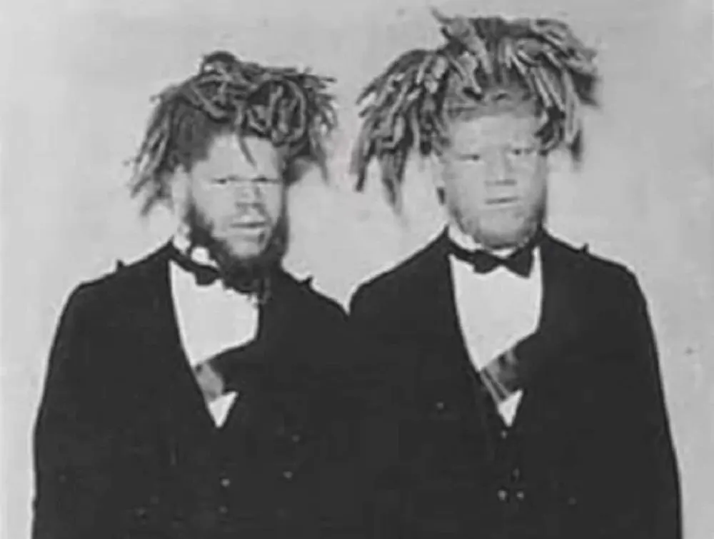 #3 Eko and Iko in a promotional photo.