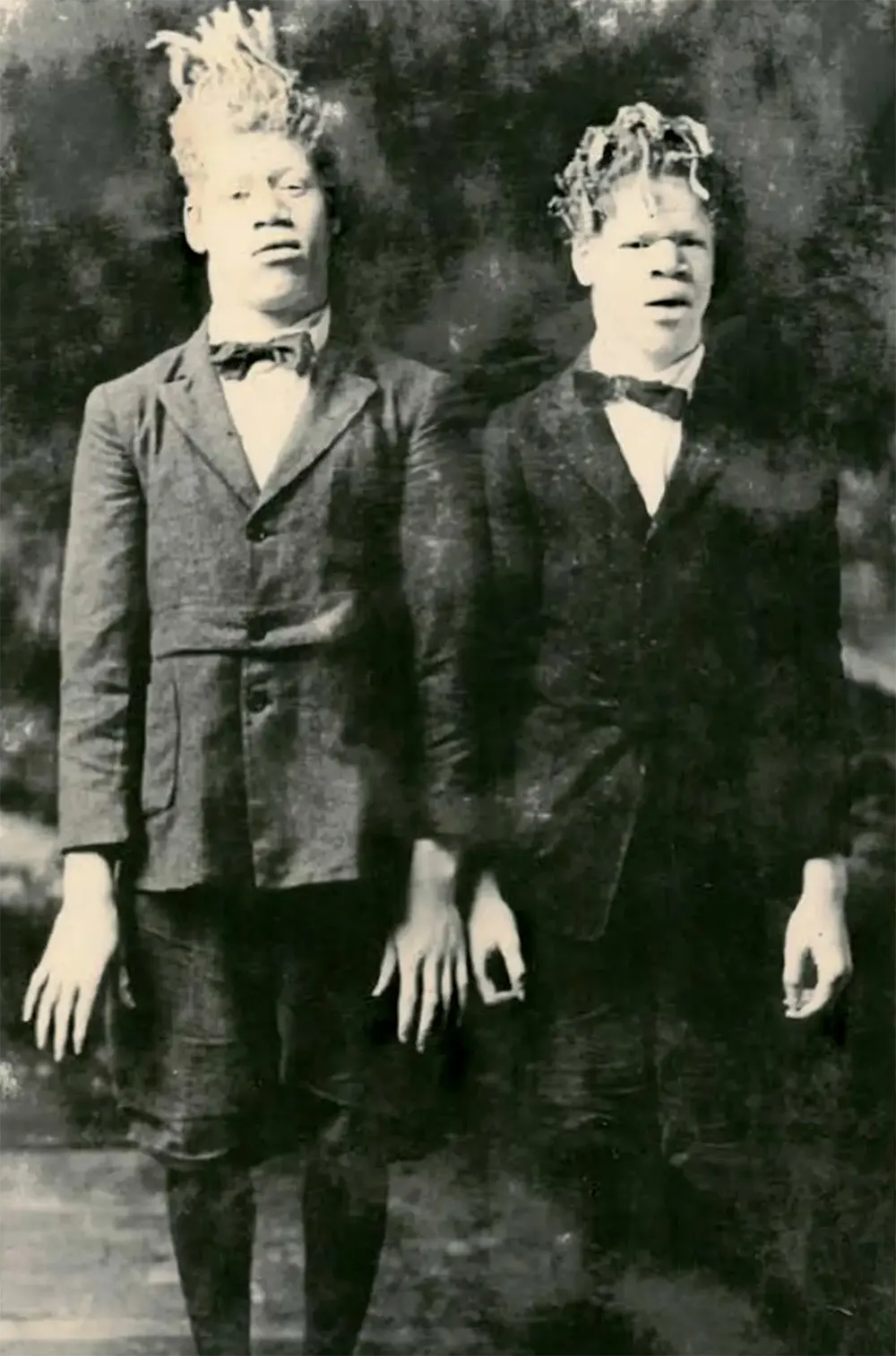 #7 George and Willie Muse in the earliest known photograph of them in the circus.