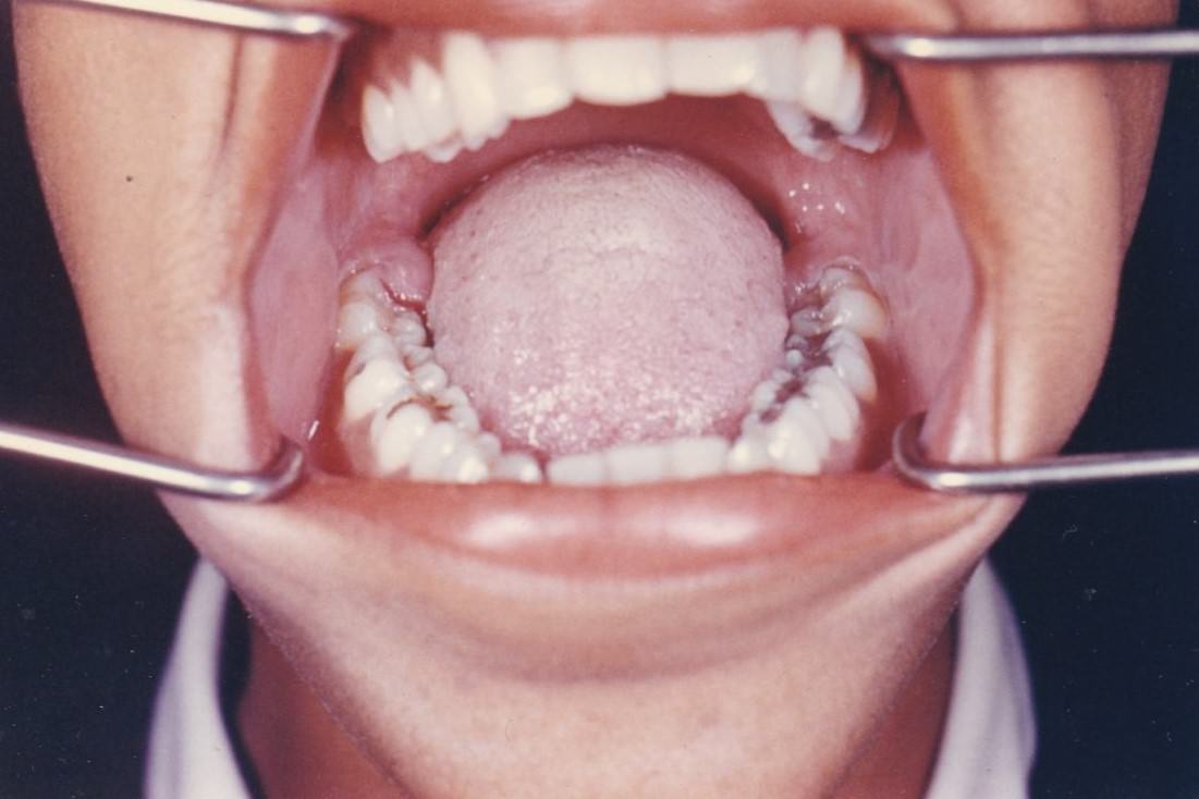 #11 Brace Yourself for Laughter: Vintage Teeth Pics, That’ll Make You Grin #11 Funny