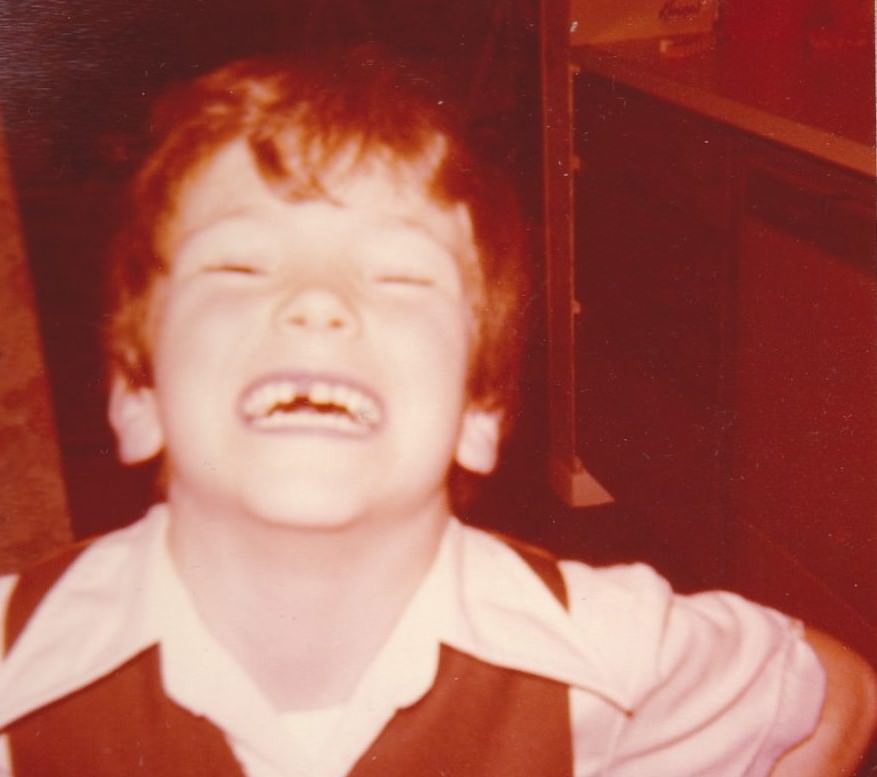 #27 Brace Yourself for Laughter: Vintage Teeth Pics, That’ll Make You Grin #27 Funny