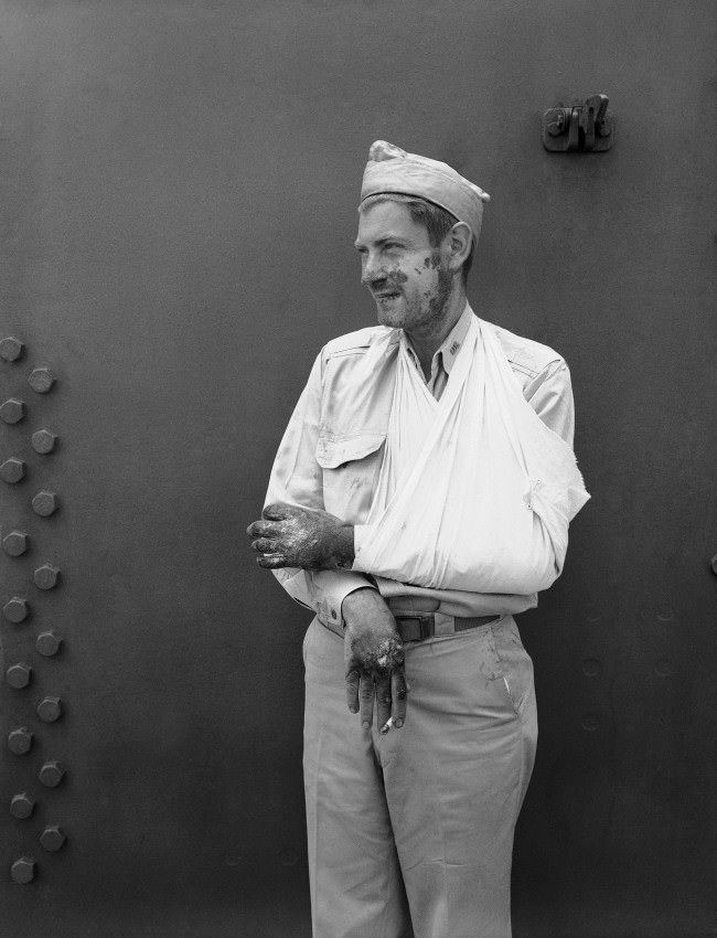 #22 Charles H. McMurtry, Associated Press war correspondent is recovering from burns received about the face and hands when a Japanese bomber crashed on the signal bridge of an aircraft carrier. 1942