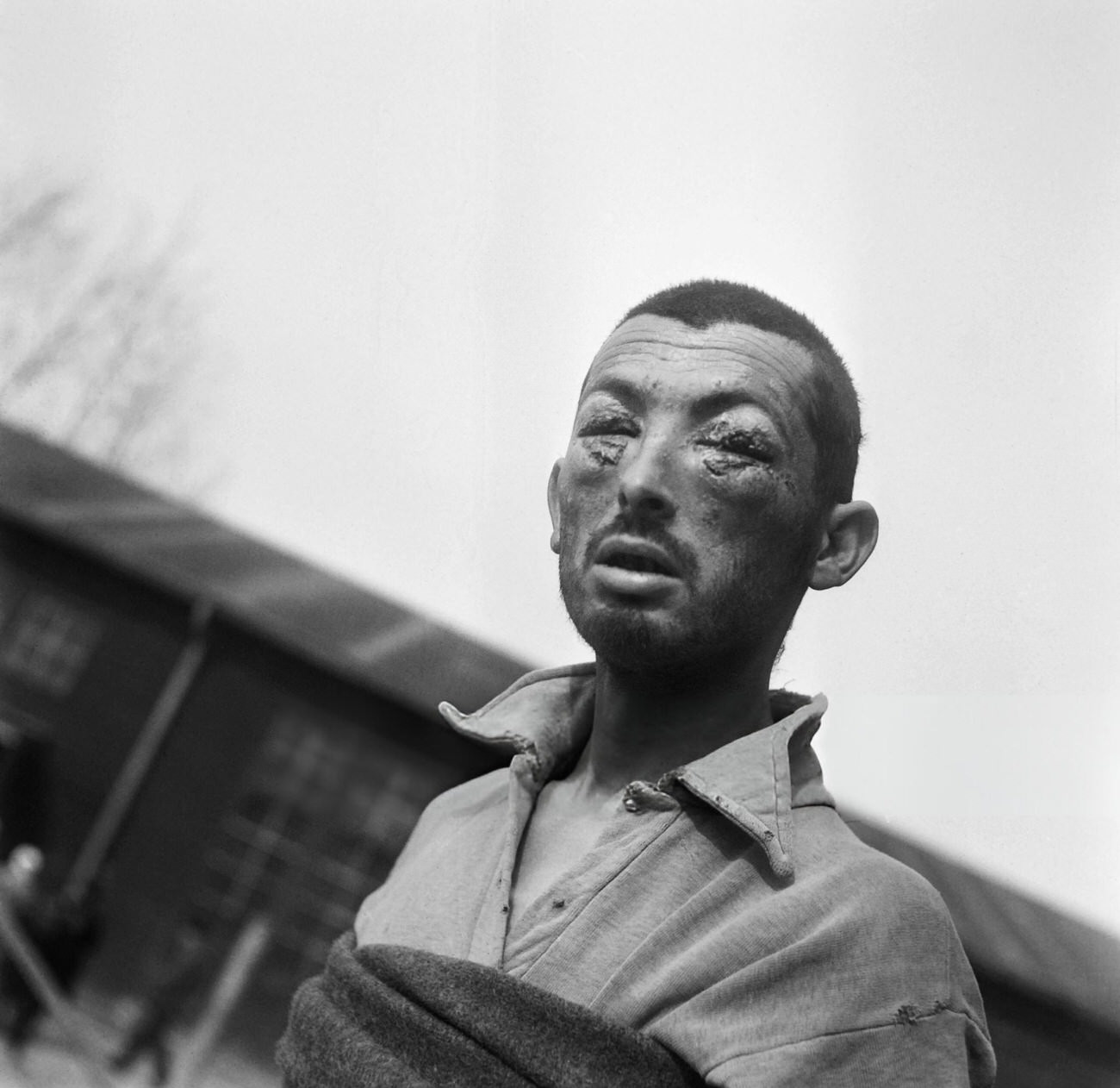 #34 A tortured prisoner is seen in the Buchenwald concentration camp, 1945.