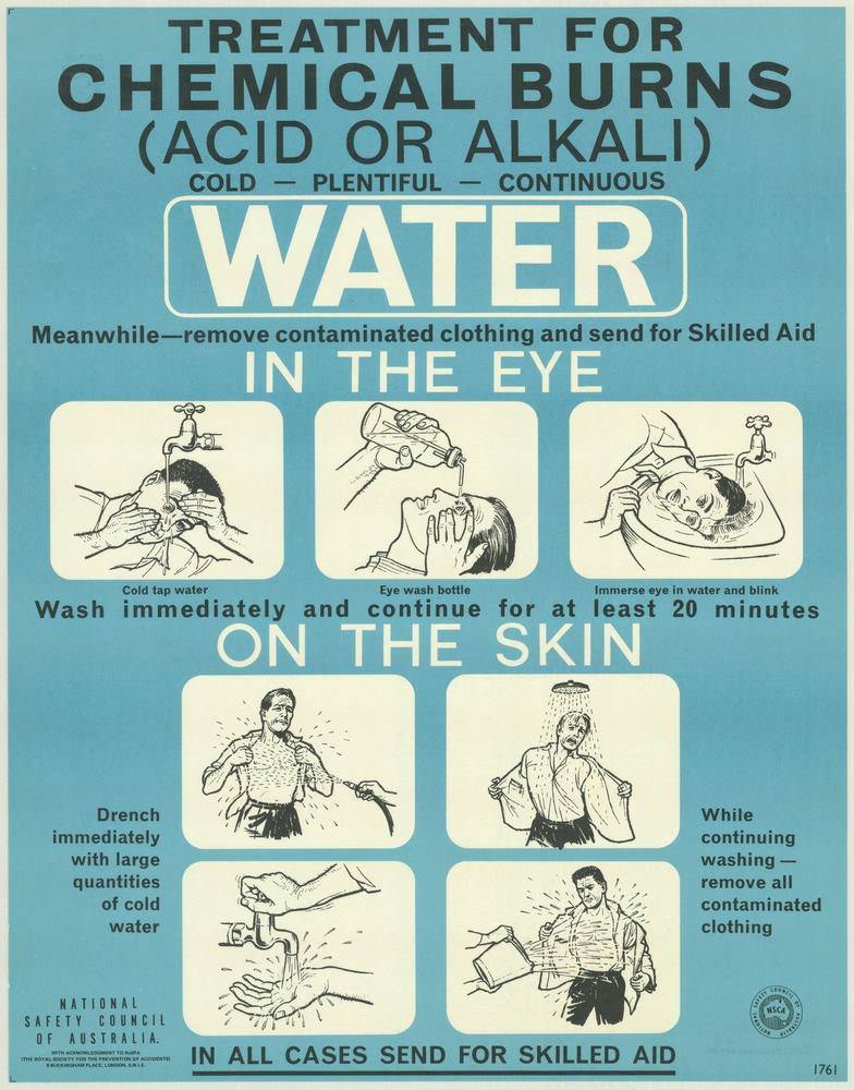 National Safety Council of Australia Posters from the 1970s: Visual Messages for Keeping People Safe and Well