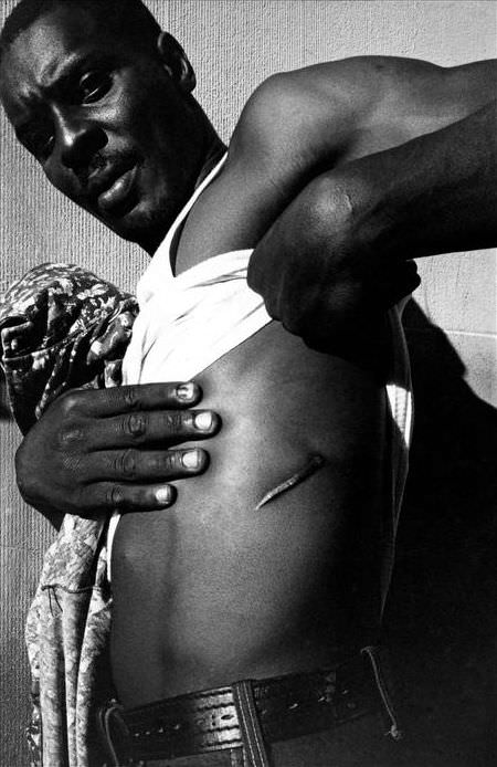 #7 A small drug dealer shows one of his scars from multiple stab wounds, 1978.